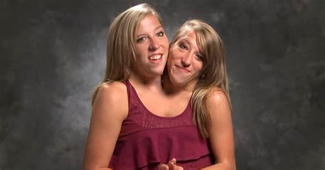 conjoined twins porn|conjoined twins gets fucked Search